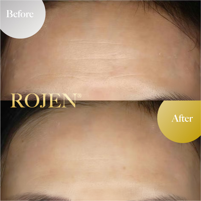 父の日のプレゼントにも🤍
🤩Men's Before and After🤩
https://rojen.jp/tag/mens/
✨️✨️✨️✨️✨️✨️✨️
魔法のひと滴
塗るサプリ🌹
美整オイル®
ROJEN公式サイト
🇯🇵日本
rojen.jp
スキンケアご購入ダイレクトページ
https://rojen.jp/bisei-oil/shop/
🇺🇸USA
rojenusa.com
ROJEN Organic Skincare
https://rojenusa.com/biseioil/
#ROJEN #ロジェン #biseioil #美整オイル #オーガニック #スキンケア #美肌 #紫外線対策 #紫外線 #シミ対策 #シワ対策 #乾燥肌対策 #免疫力強化 #弾力ある肌に変身