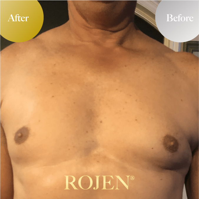 父の日のプレゼントにも🤍
🤩Men's Before and After🤩
https://rojen.jp/tag/mens/
✨️✨️✨️✨️✨️✨️✨️
魔法のひと滴
塗るサプリ🌹
美整オイル®
ROJEN公式サイト
🇯🇵日本
rojen.jp
スキンケアご購入ダイレクトページ
https://rojen.jp/bisei-oil/shop/
🇺🇸USA
rojenusa.com
ROJEN Organic Skincare
https://rojenusa.com/biseioil/
#ROJEN #ロジェン #biseioil #美整オイル #オーガニック #スキンケア #美肌 #紫外線対策 #紫外線 #シミ対策 #シワ対策 #乾燥肌対策 #免疫力強化 #弾力ある肌に変身