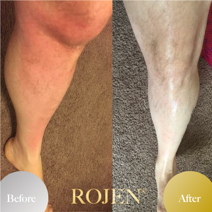 父の日のプレゼントにも🤍
🤩Men's Before and After🤩
https://rojen.jp/tag/mens/
✨️✨️✨️✨️✨️✨️✨️
魔法のひと滴
塗るサプリ🌹
美整オイル®
ROJEN公式サイト
🇯🇵日本
rojen.jp
スキンケアご購入ダイレクトページ
https://rojen.jp/bisei-oil/shop/
🇺🇸USA
rojenusa.com
ROJEN Organic Skincare
https://rojenusa.com/biseioil/
#ROJEN #ロジェン #biseioil #美整オイル #オーガニック #スキンケア #美肌 #紫外線対策 #紫外線 #シミ対策 #シワ対策 #乾燥肌対策 #免疫力強化 #弾力ある肌に変身
